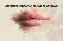 alergiczne zapalenie czerwieni wargowej 