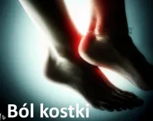 Ból kostki