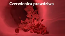 czerwienica prawdziwa