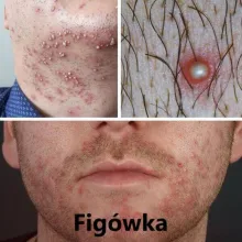 Figówka