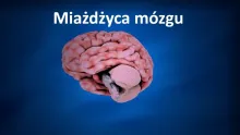 Miażdżyca naczyń mózgowych, miażdżyca mózgu 