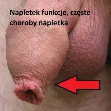 Napletek