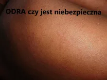 odra czy jest niebezpieczna