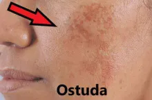 ostuda