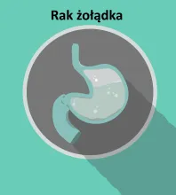 Rak żołądka 