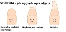 Stulejka 