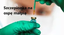 szczepionka na ospę małpią