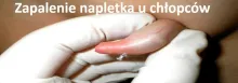 zapalenie napletka u chłopców