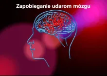 Zapobieganie udarom mózgu
