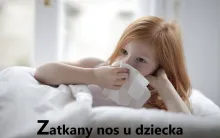 Zatkany nos u dziecka 