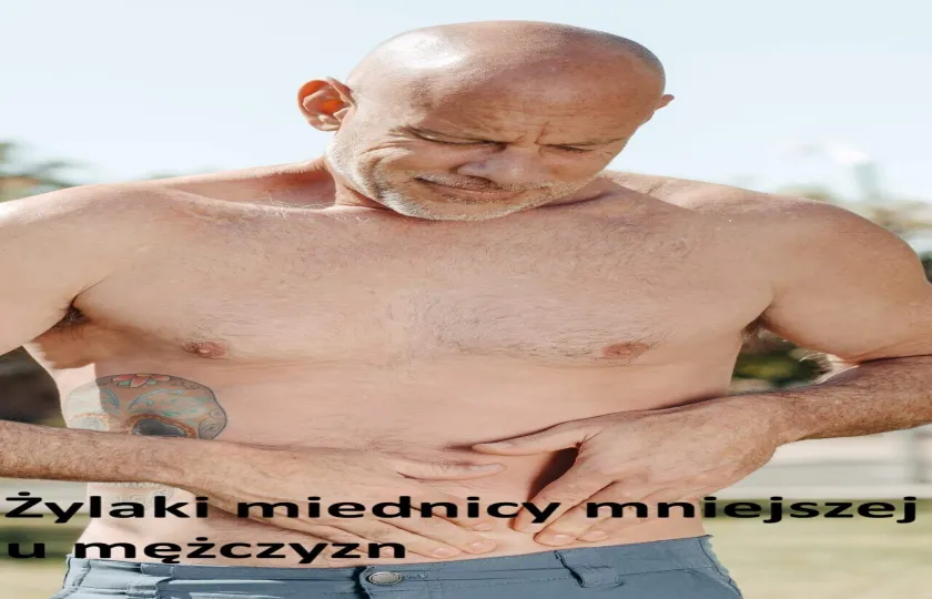 Żylaki miednicy mniejszej u mężczyzn