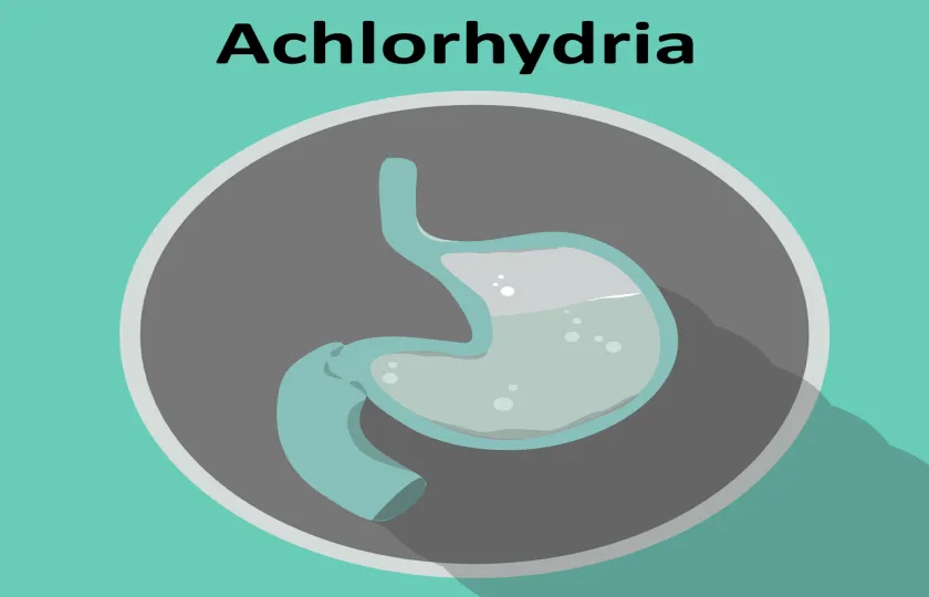Achlorhydria, bezkwaśność, bezkwasowość 