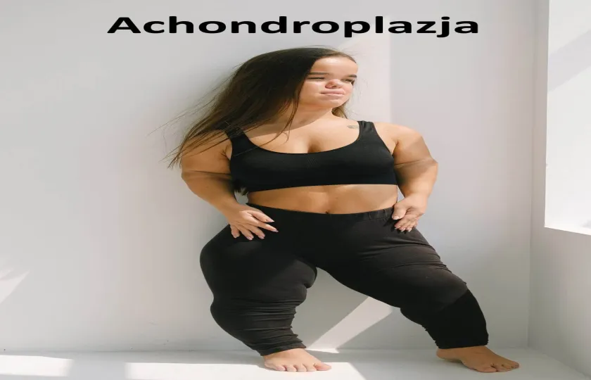 ACHONDROPLAZJA, CHONDRODYSTROFIA, KARŁOWATOŚĆ, NISKOROSŁOŚĆ 