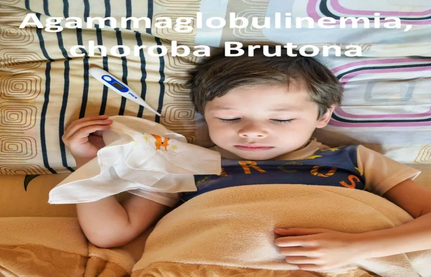 Agammaglobulinemia, choroba Brutona