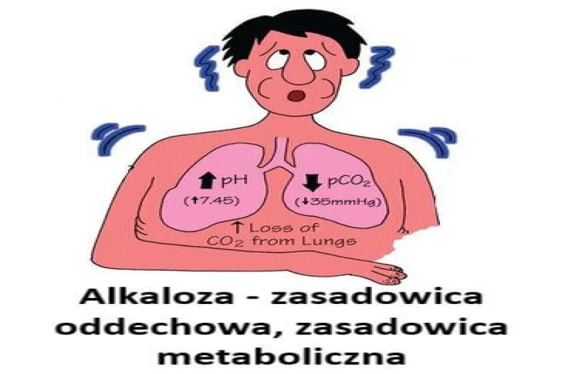 Alkaloza