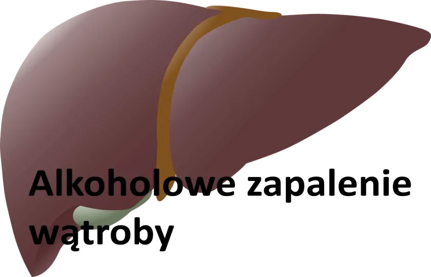Alkoholowe zapalenie wątroby 