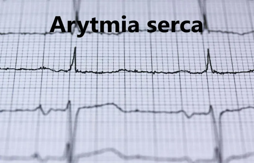 Arytmia serca
