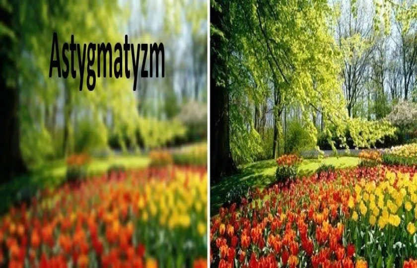 Astygmatyzm 