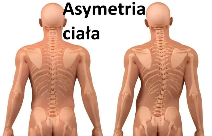 Asymetria ciała