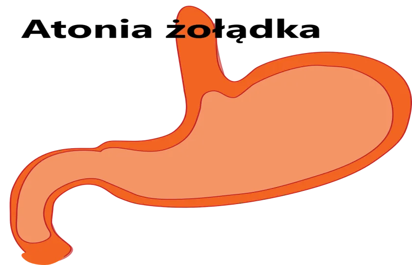 Atonia żołądka 