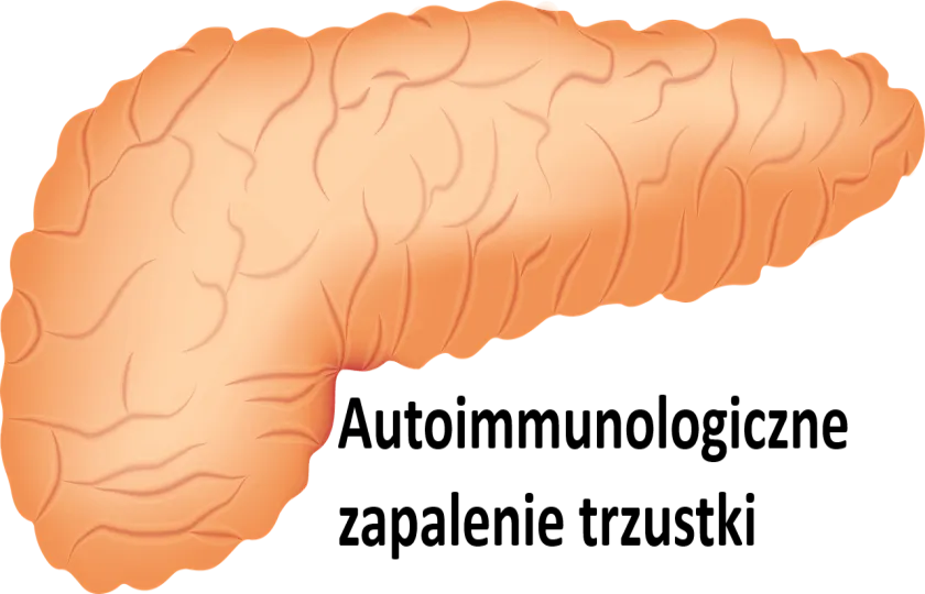 Autoimmunologiczne zapalenie trzustki 