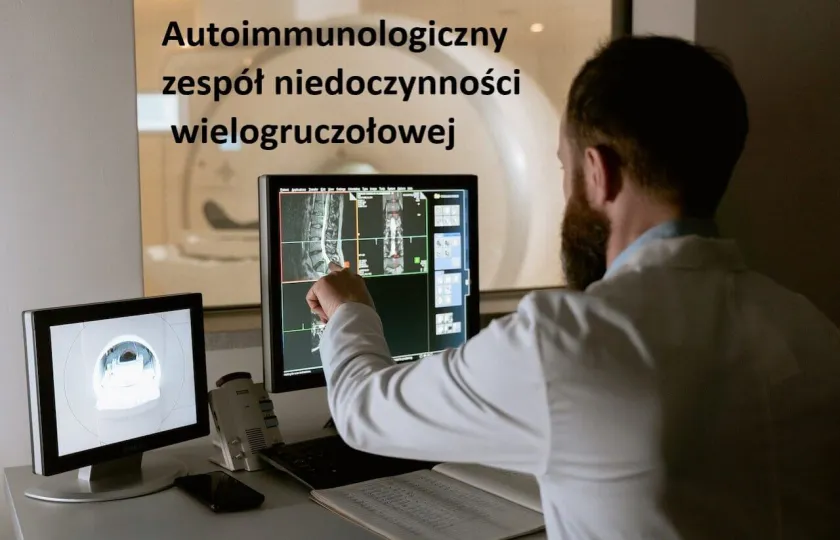 Autoimmunologiczny zespół niedoczynności wielogruczołowej