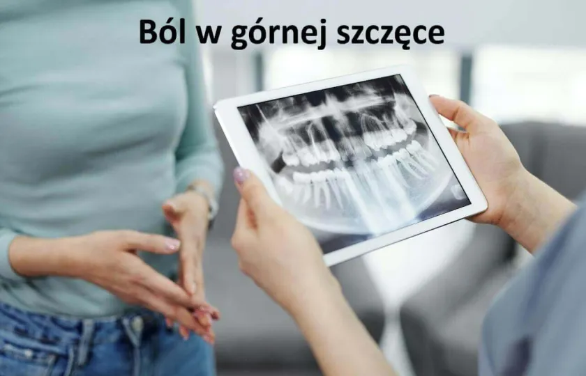 Ból w górnej szczęce, Górna szczęka ból