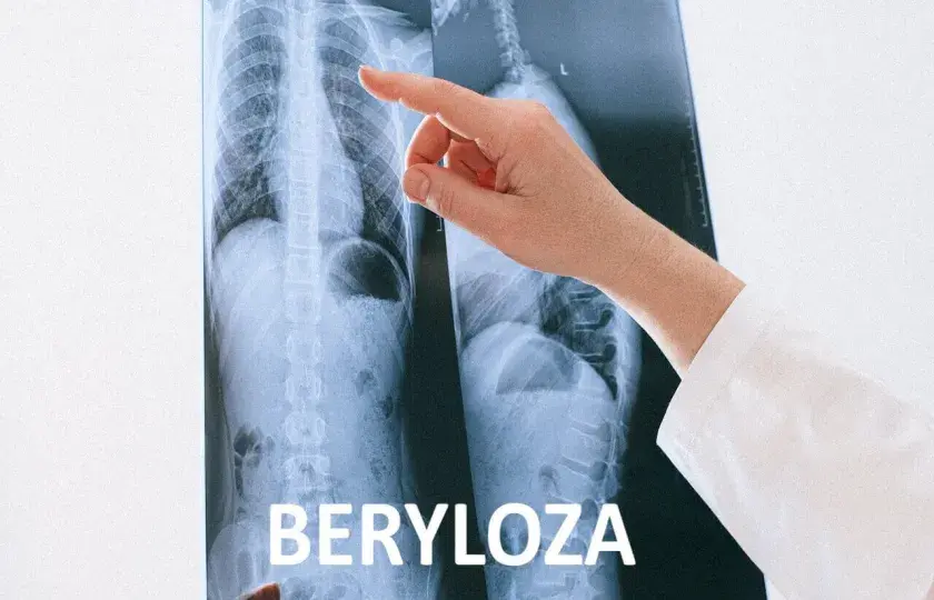 Beryloza 