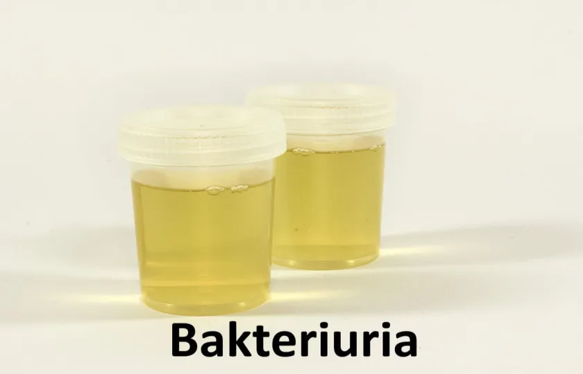 Bakteriuria