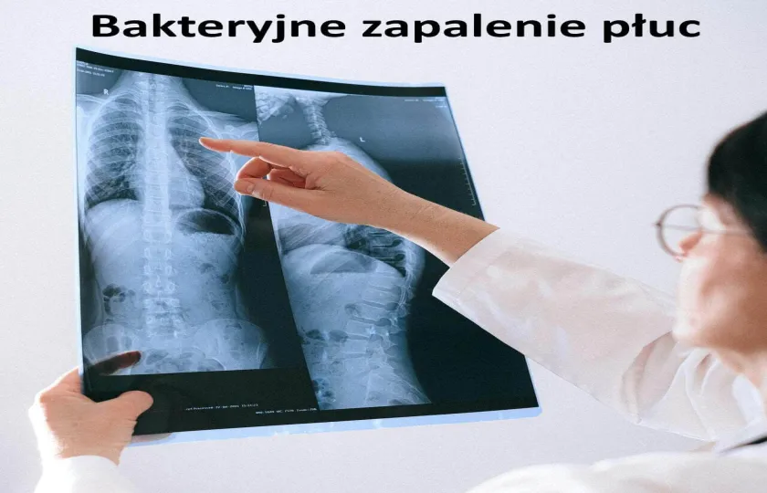 Bakteryjne zapalenie płuc 