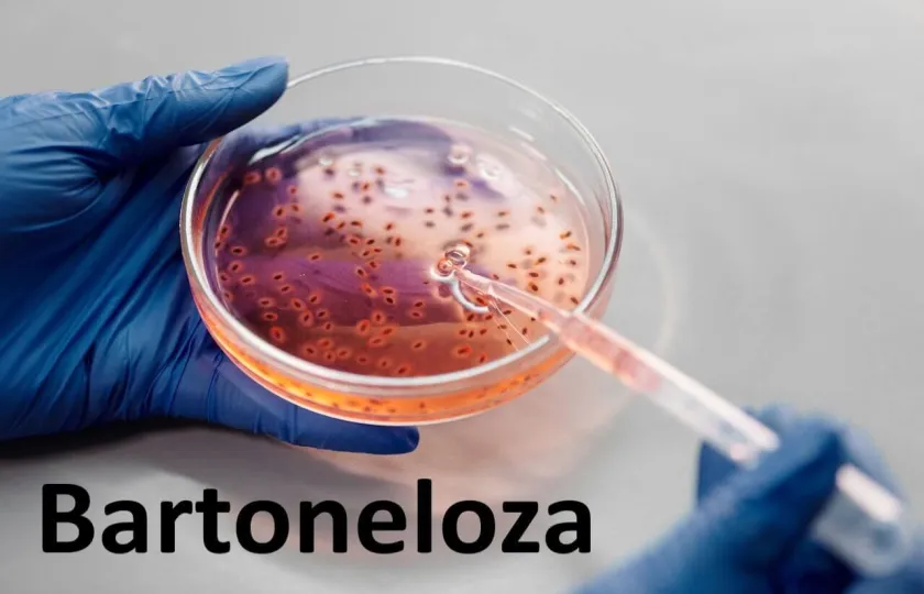 Bartoneloza 