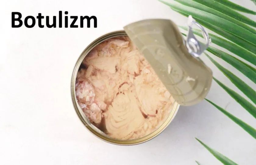 Botulizm zatrucie jadem kiełbasianym 