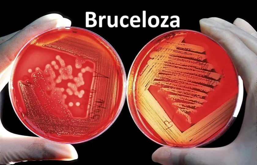 Bruceloza 