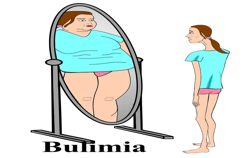 Bulimia 