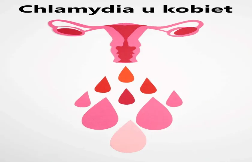 Chlamydia u kobiet