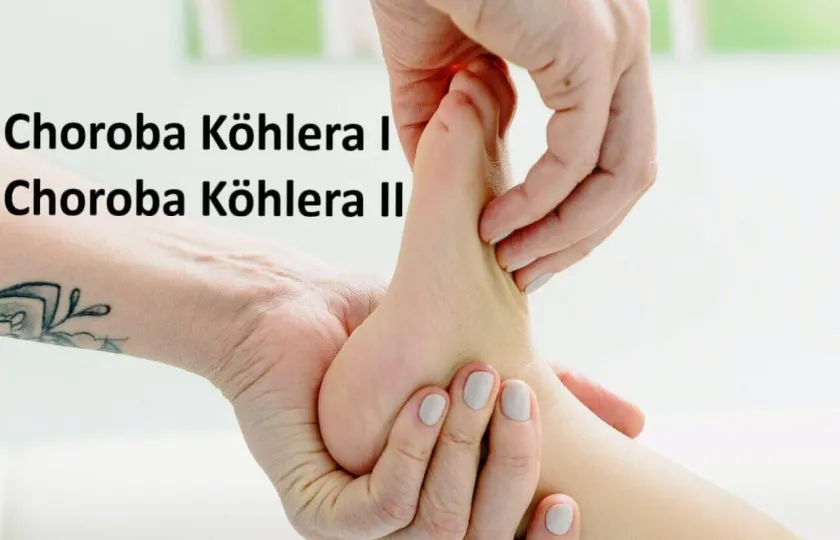 Choroba Köhlera I, Choroba Köhlera II 