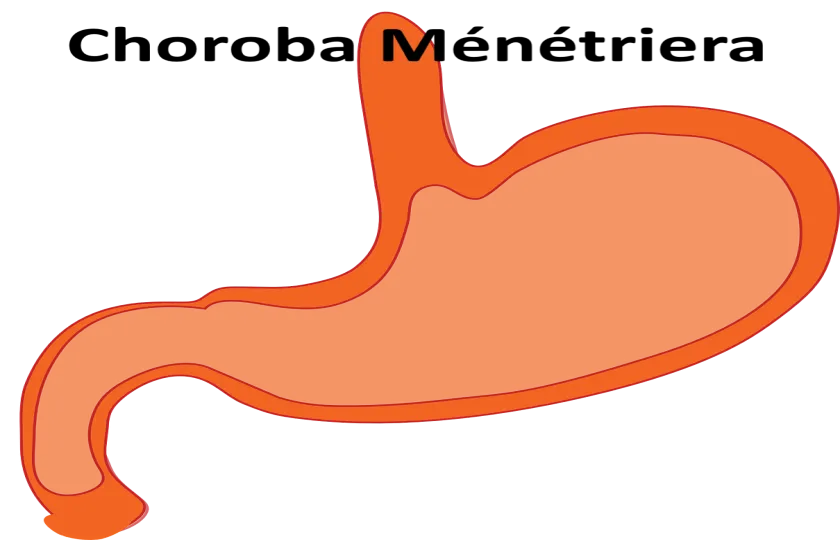 Choroba Ménétriera