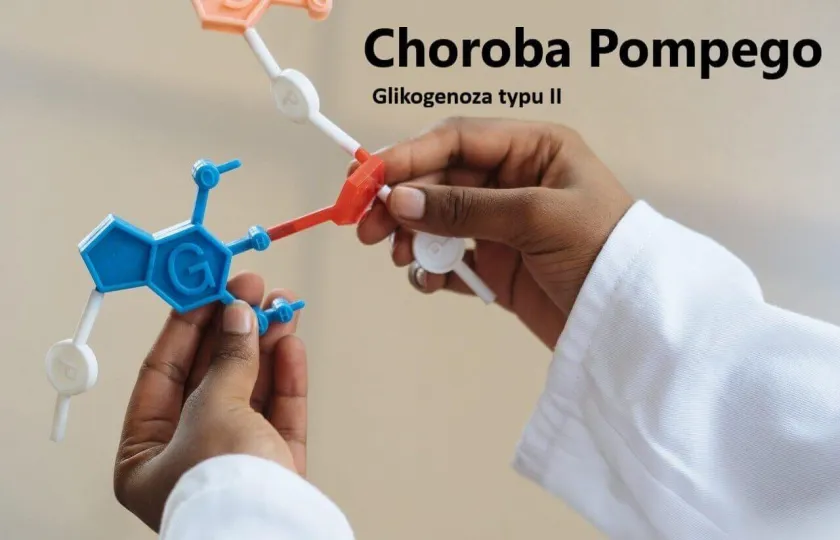 Choroba Pompego, glikogenoza typu II 