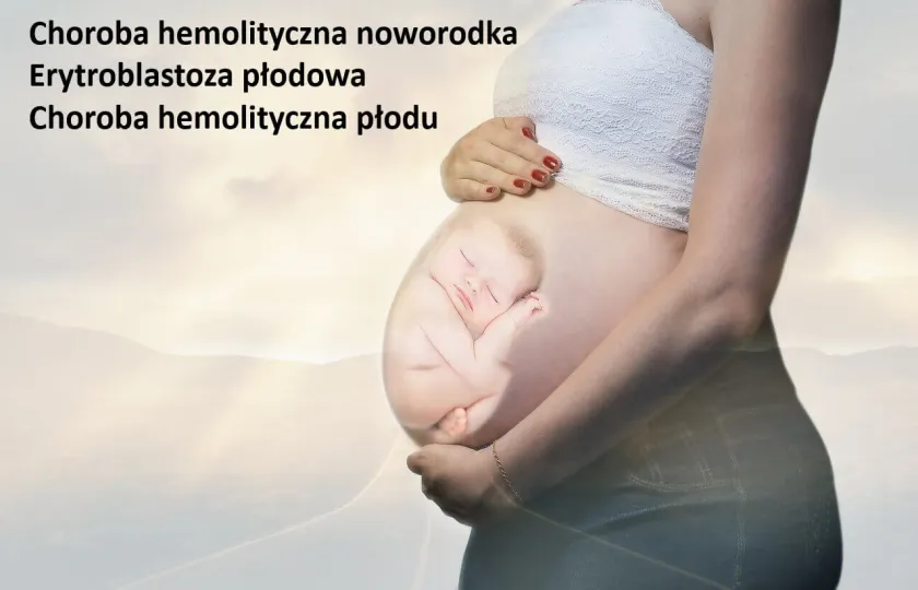 Choroba hemolityczna noworodka, erytroblastoza płodowa choroba hemolityczna płodu