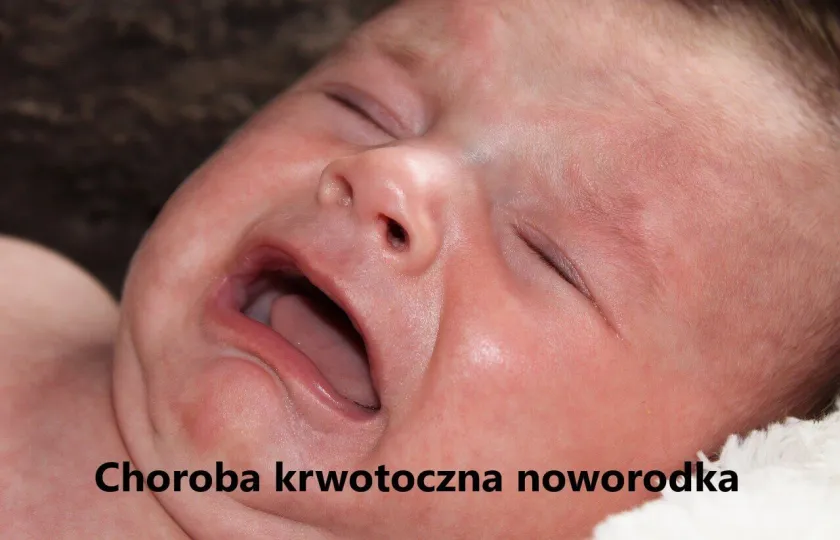 Choroba krwotoczna noworodka