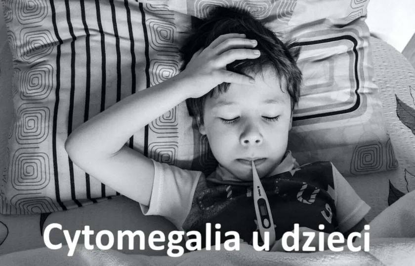 CYTOMEGALIA U DZIECI CMV objawy, ile trwa leczenie, rokowanie, gorączka inne objawy