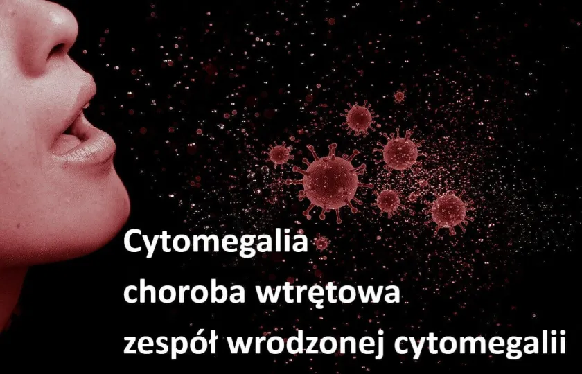 Cytomegalia, choroba wtrętowa, zespół wrodzonej cytomegalii