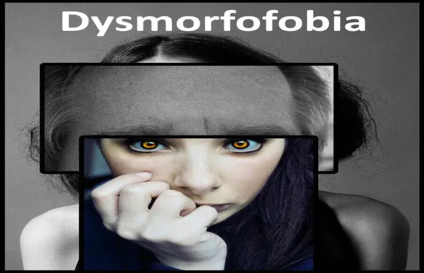 Dysmorfofobia