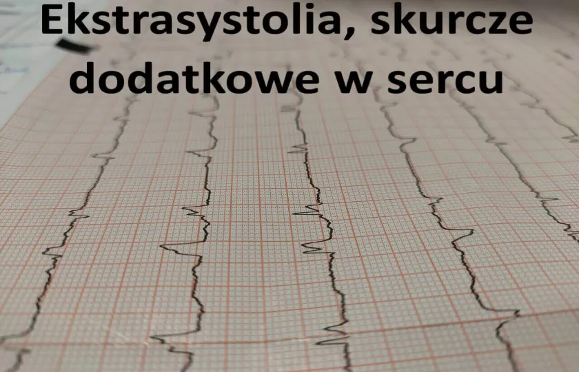 Ekstrasystolia, skurcze dodatkowe w sercu