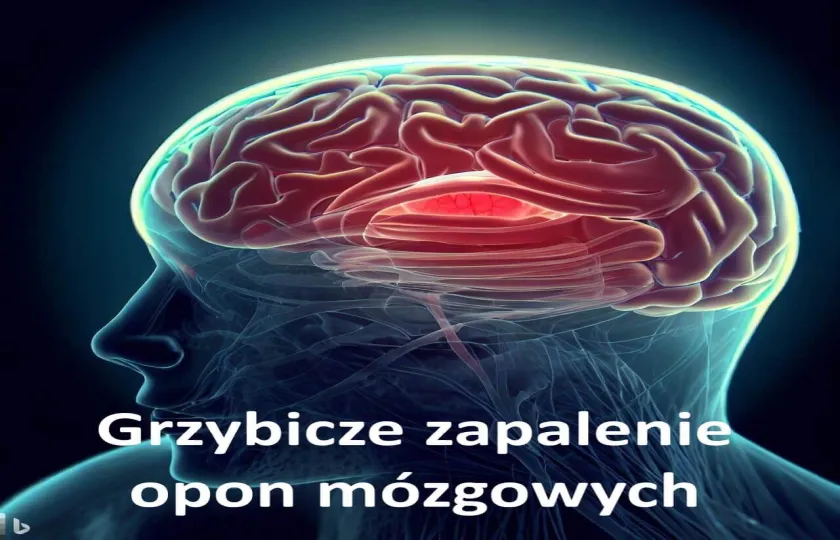 Grzybicze zapalenie opon mózgowych 