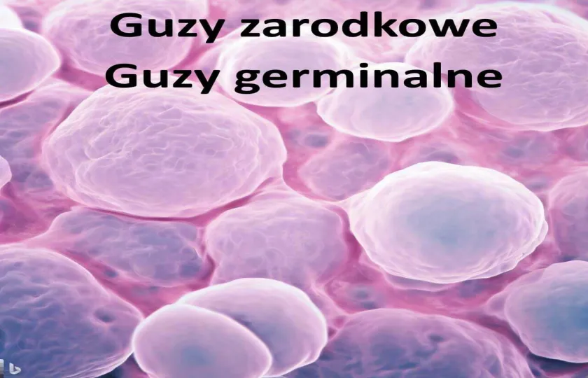 Guzy zarodkowe, guzy germinalne