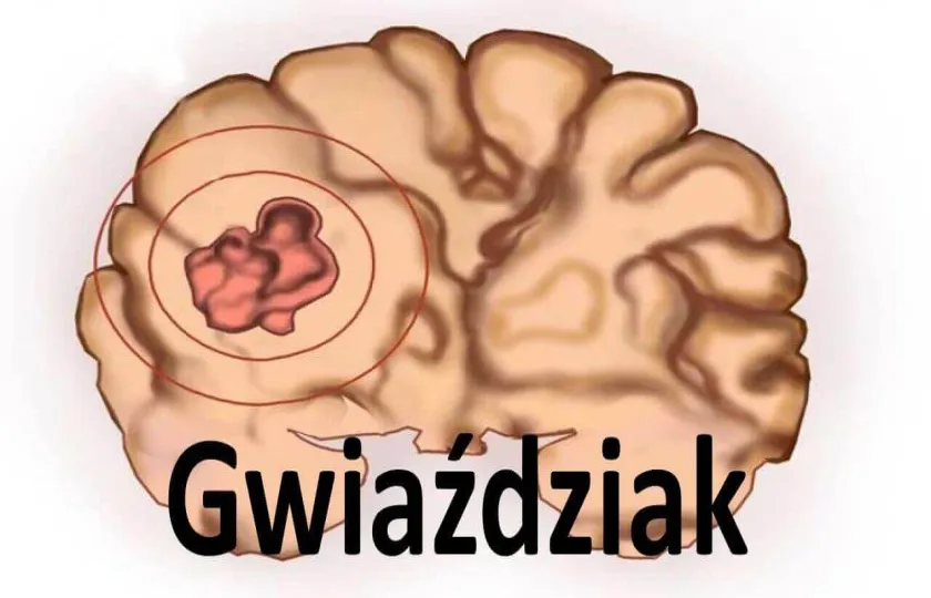 Gwiaździak 