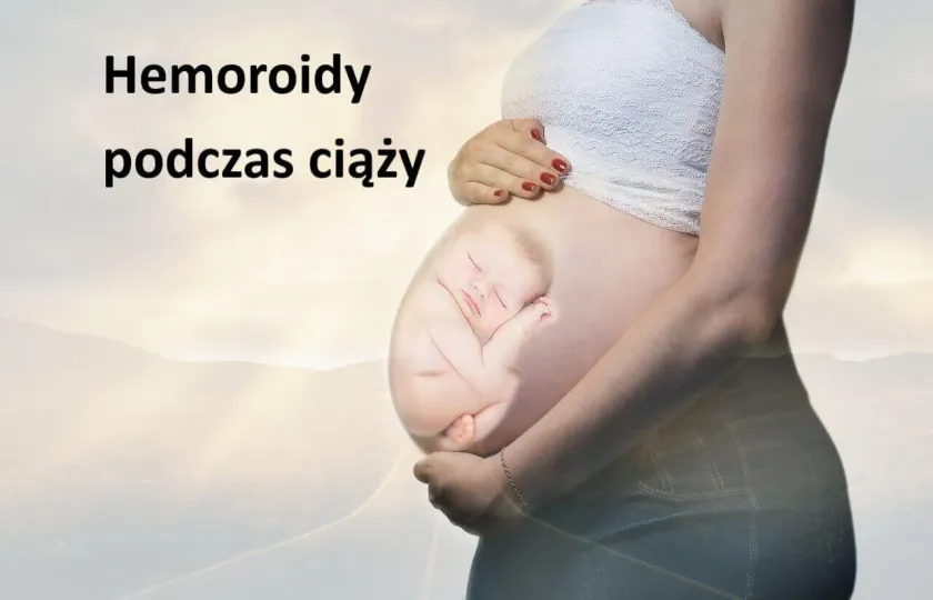 Hemoroidy podczas ciąży, hemoroidy w ciąży