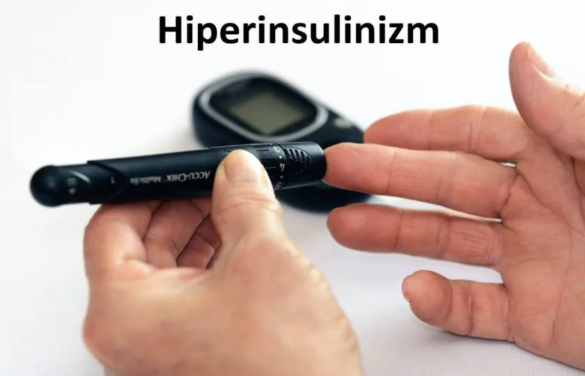 Hiperinsulinizm