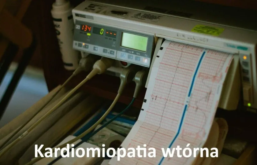 Kardiomiopatia wtórna